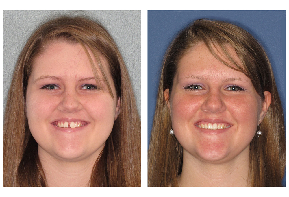 A Plus Dentistry