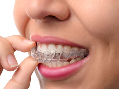 A person with braces, smiling at the camera.