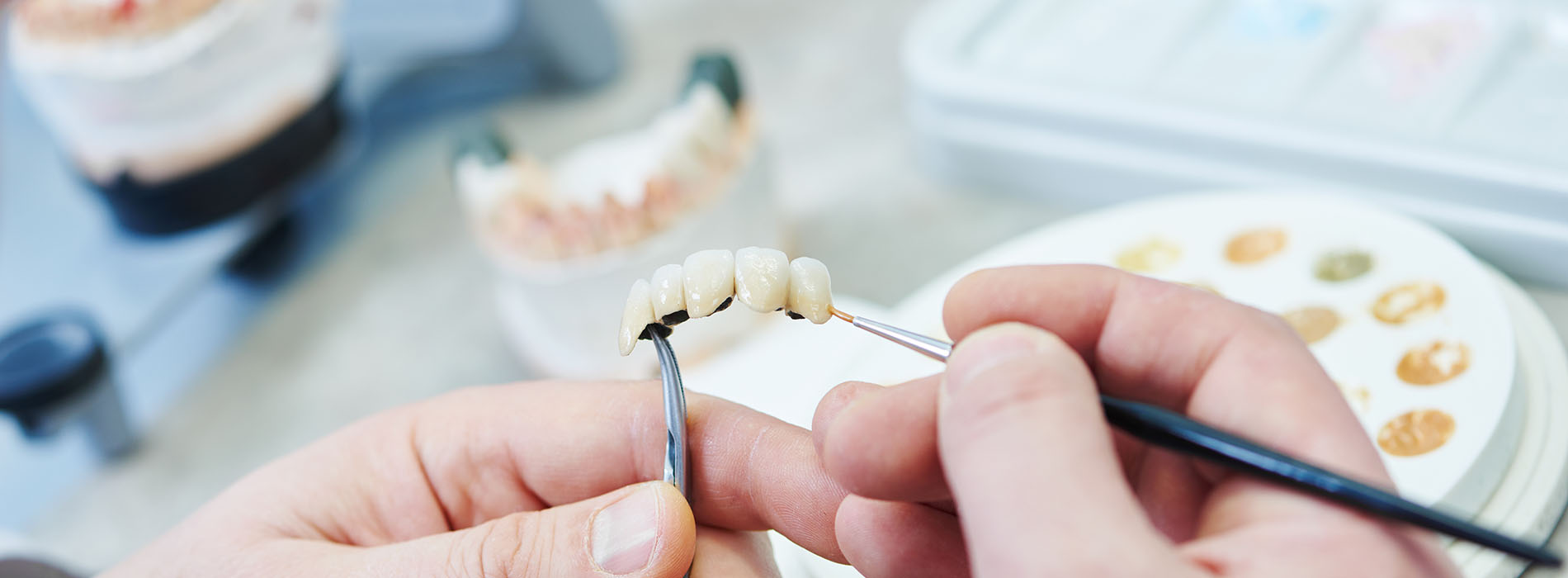 The image shows a person working on a dental implant in a laboratory setting.