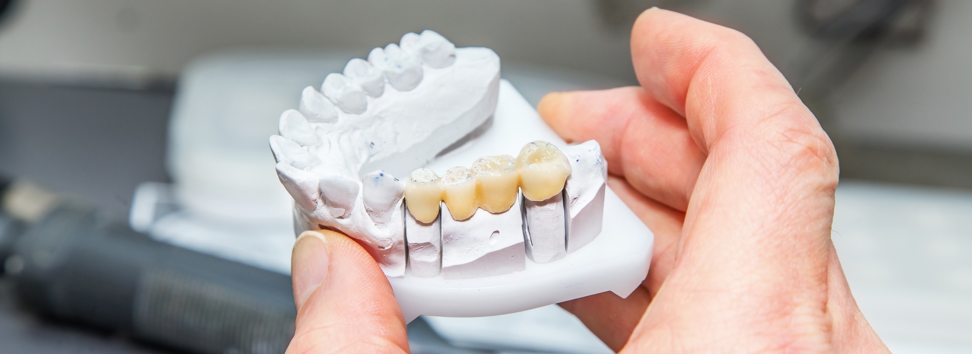 The image shows a person holding a 3D printed dental model with visible teeth and gum structures, highlighting a person s smile design, possibly for educational or marketing purposes.