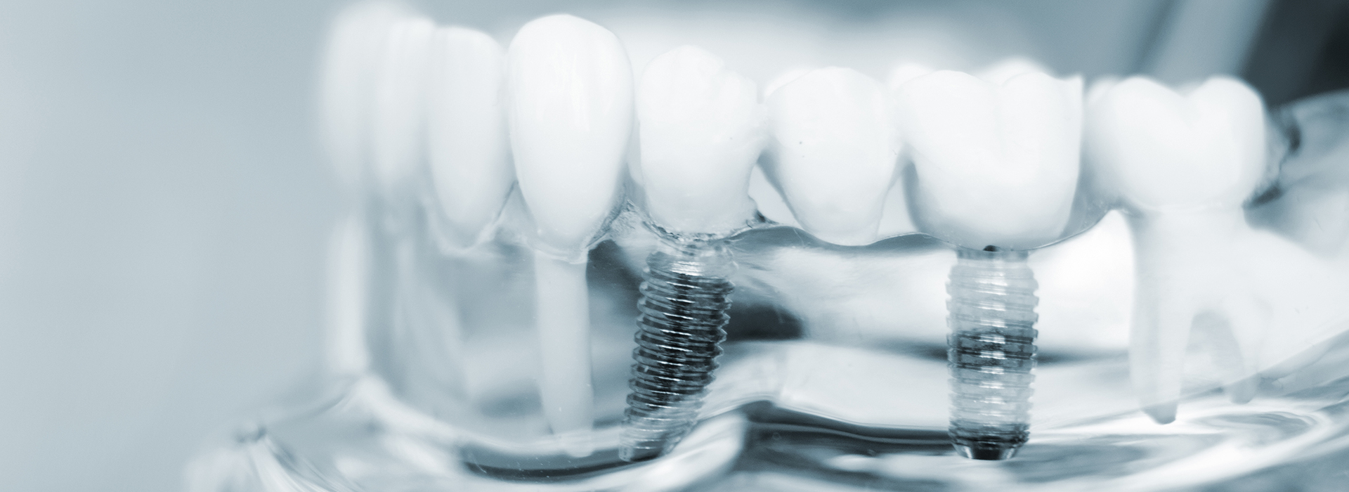 The image displays a close-up view of multiple toothbrushes with bristles, placed against a blurred background, likely for dental hygiene purposes.