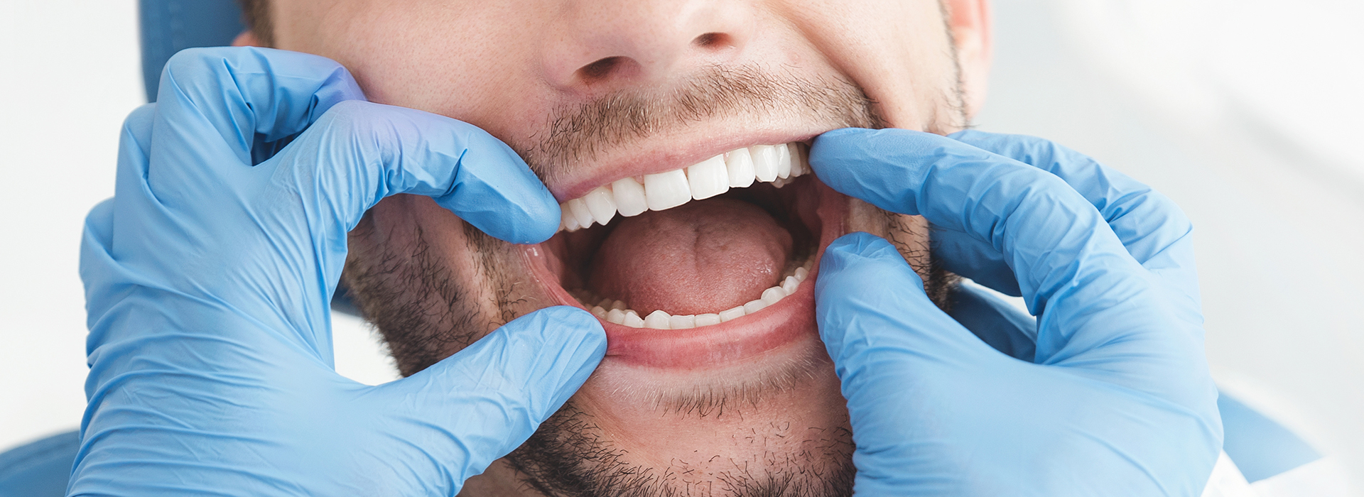 The image shows a person with their mouth open while wearing blue gloves, with a dental setting in the background.