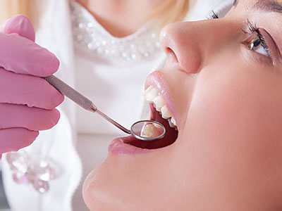 The image shows a woman receiving dental care from a professional, with her mouth open wide for treatment.
