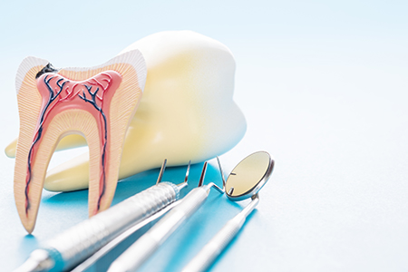 The image shows a dental model with a tooth missing, placed on a table next to dental instruments, including tweezers and a scalpel, with a focus on oral health care.