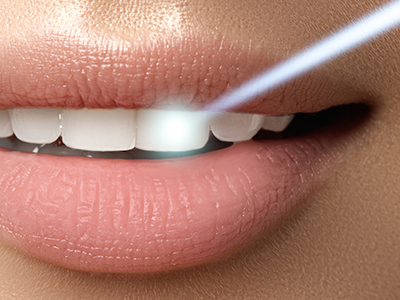 The image features a close-up of a person s smiling mouth with teeth, displaying a bright smile with pink lips, and a small green spot on the lower lip area.