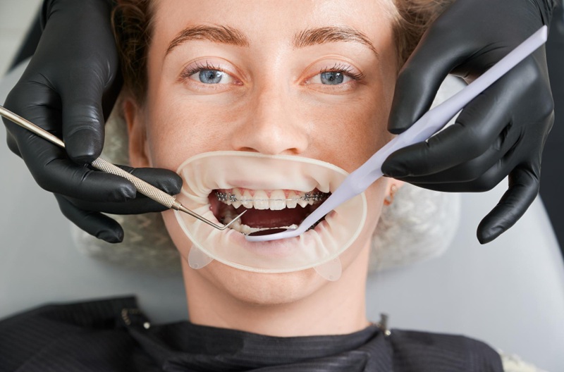 Sedation-dentistry-in-cumming-ga
